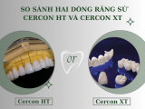 SO SÁNH HAI DÒNG RĂNG SỨ CERCON HT VÀ CERCON XT 