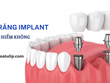 TRỒNG RĂNG IMPLAN CÓ NGUY HIỂM KHÔNG