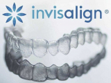 NIỀNG RĂNG TRONG SUỐT INVISALIGN