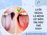 LƯỠI TRẮNG LÀ BỆNH GÌ? ĐIỀU TRỊ NHƯ THẾ NÀO?