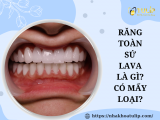 RĂNG TOÀN SỨ LAVA LÀ GÌ? CÓ MẤY LOẠI? 