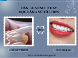 NÊN DÁN SỨ HAY BỌC RĂNG SỨ SẼ TỐT HƠN?