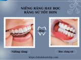 NÊN CHỌN NIỀNG RĂNG HAY BỌC RĂNG SỨ ĐỂ CẢI THIỆN NỤ CƯỜI
