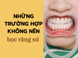 NHỮNG TRƯỜNG HỢP KHÔNG NÊN BỌC RĂNG SỨ MÀ BẠN NÊN BIẾT