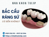 BẮC CẦU RĂNG SỨ CÓ BỀN KHÔNG?