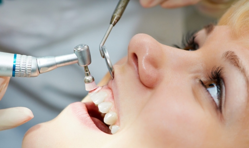 CÓ NÊN ĐÁNH BÓNG RĂNG