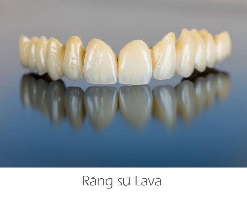 Răng Sứ Lava: Phân Tích Ưu, Nhược Điểm Và Giá Thành Thực Hiện