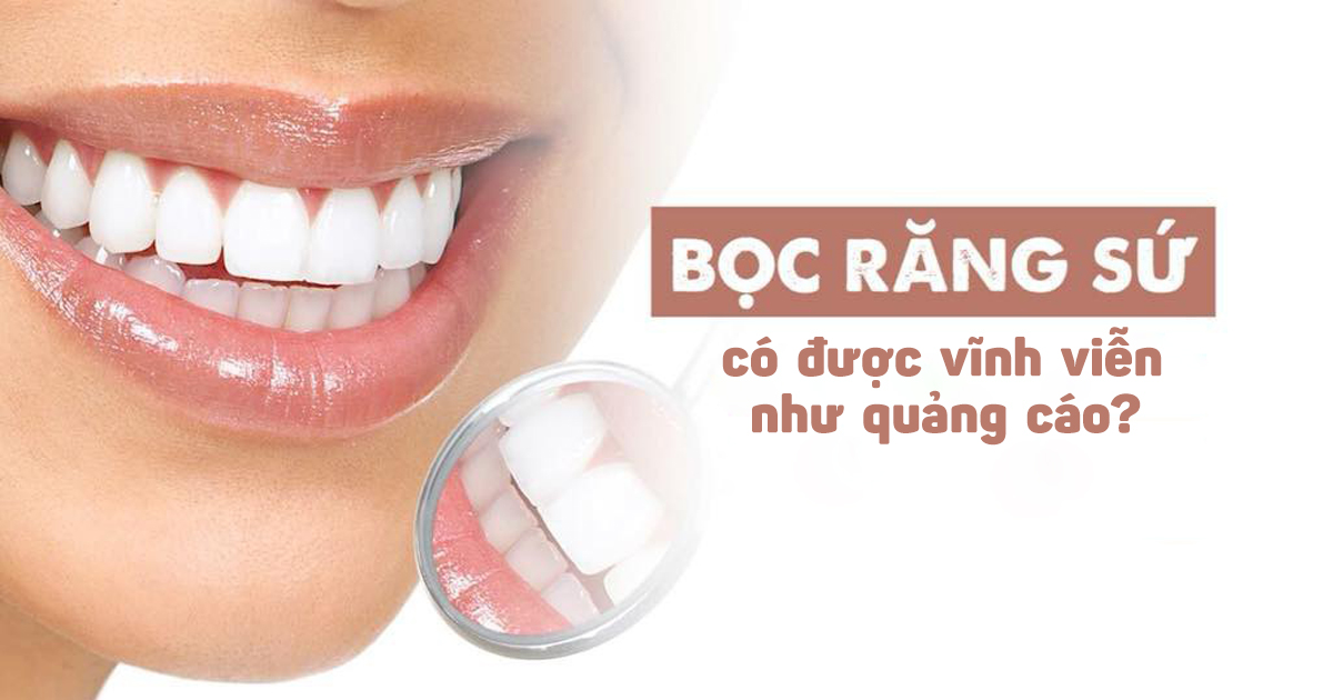 Bọc răng sứ có được vĩnh viễn như quảng cáo? - Nha Khoa LINH XUÂN