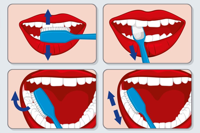 Chải răng nhẹ nhàng trên toàn bộ các mặt của răng