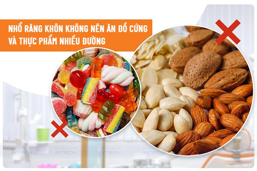 Nhổ răng khôn kiêng gì để giảm đau và nhanh lành vết thương?