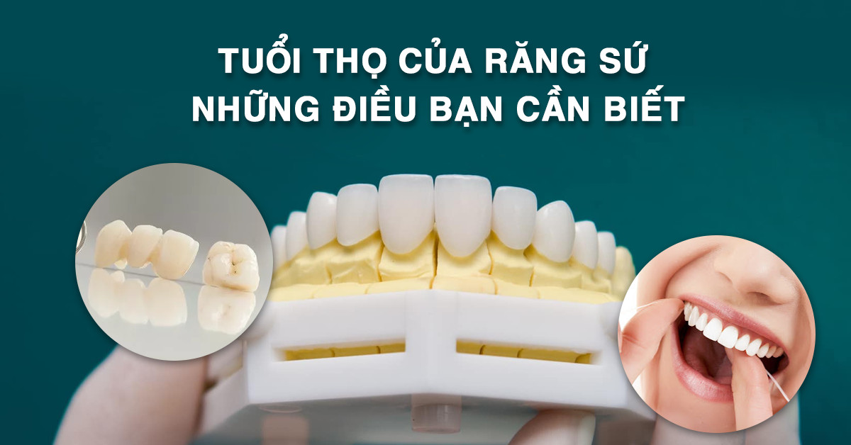 Tuổi thọ của răng sứ - Những điều bạn cần biết. - Nha khoa thẩm mỹ Queen  Smile