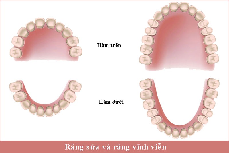 Răng sữa và răng vĩnh viễn khác nhau như thế nào?