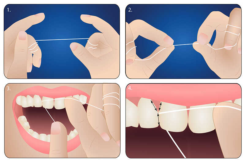 Cách dùng chỉ nha khoa: Hướng dẫn sử dụng tăm chỉ nha khoa đúng